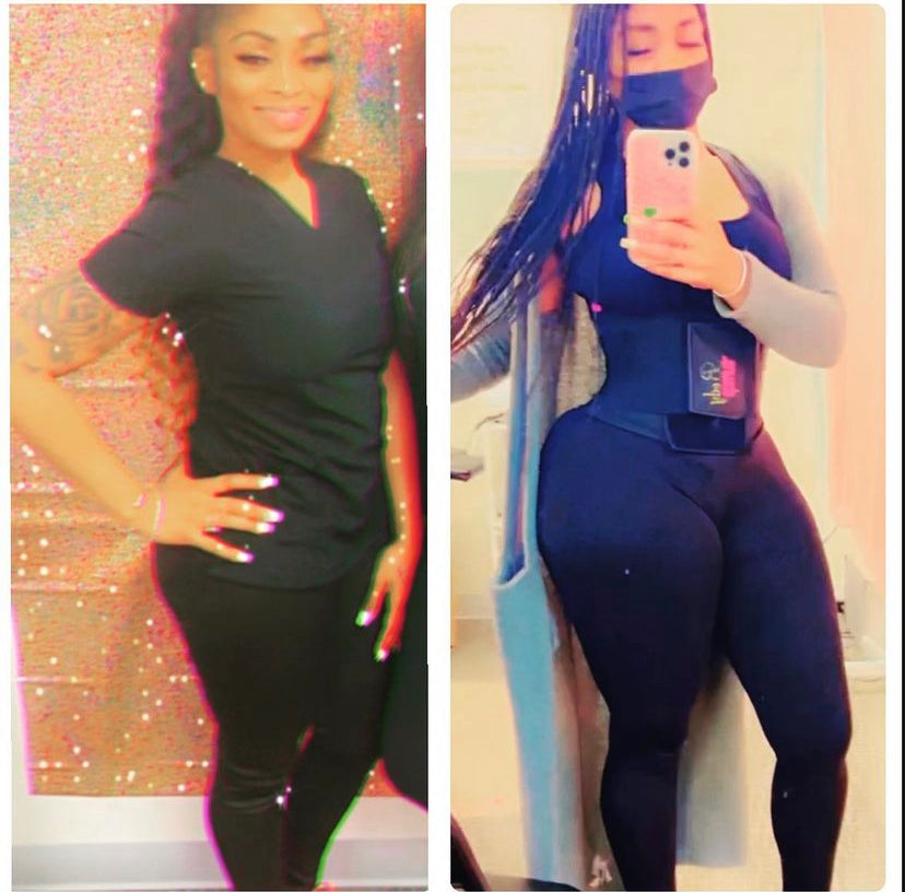 Vixen BBL Capsules